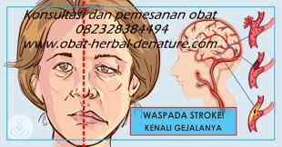 Image Obat Herbal Penyakit Stroke De Nature Indonesia